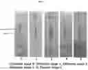 Fig. 08 - Kit for tracking and diagnosing degree of progressive chronic hepatitis and liver fibrosis by measuring asialo (alpha)1-acid glycoprotein as hepatocellular injury marker and use thereof