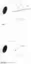 Fig. 02 - Ophthalmic wound closure devices and methods