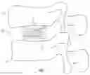 Fig. 02 - Expandable fusion device and method of installation thereof