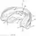 Fig. 03 - Oral appliance