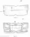 Fig. 06 - Oral appliance