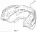 Fig. 07 - Oral appliance