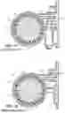 Fig. 16 - Blood Treatment Systems
