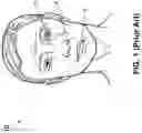 Fig. 02 - Method and apparatus for transcutaneous facial nerve stimulation and applications thereof