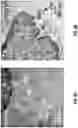 Fig. 07 - Method of high throughput screening of chemical compounds suppressing nucleolar hypertrophy