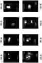 Fig. 09 - Method of high throughput screening of chemical compounds suppressing nucleolar hypertrophy