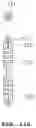 Fig. 20 - Contact and test socket device for testing semiconductor device