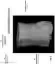 Fig. 05 - Systems and methods for three-dimensional visualization of deviation of volumetric structures with colored surface structures