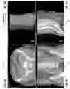 Fig. 06 - Systems and methods for three-dimensional visualization of deviation of volumetric structures with colored surface structures