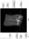 Fig. 07 - Systems and methods for three-dimensional visualization of deviation of volumetric structures with colored surface structures