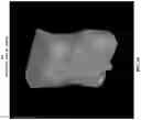 Fig. 08 - Systems and methods for three-dimensional visualization of deviation of volumetric structures with colored surface structures