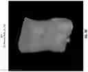 Fig. 09 - Systems and methods for three-dimensional visualization of deviation of volumetric structures with colored surface structures