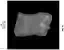 Fig. 10 - Systems and methods for three-dimensional visualization of deviation of volumetric structures with colored surface structures