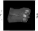 Fig. 11 - Systems and methods for three-dimensional visualization of deviation of volumetric structures with colored surface structures