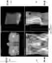 Fig. 12 - Systems and methods for three-dimensional visualization of deviation of volumetric structures with colored surface structures