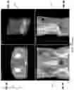 Fig. 13 - Systems and methods for three-dimensional visualization of deviation of volumetric structures with colored surface structures