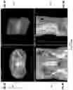 Fig. 14 - Systems and methods for three-dimensional visualization of deviation of volumetric structures with colored surface structures