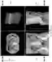 Fig. 15 - Systems and methods for three-dimensional visualization of deviation of volumetric structures with colored surface structures