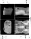 Fig. 16 - Systems and methods for three-dimensional visualization of deviation of volumetric structures with colored surface structures