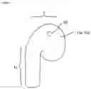 Fig. 02 - Wireless earbud having external ear contact point