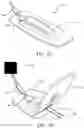 Fig. 02 - Needle electrode fixation device and associated methods