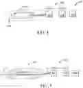 Fig. 05 - Needle electrode fixation device and associated methods