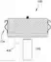 Fig. 01 - Stabilizing wires for medical device