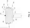 Fig. 03 - Stabilizing wires for medical device