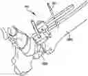 Fig. 01 - Ankle replacement system and method