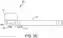 Fig. 06 - Ankle replacement system and method