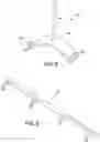Fig. 10 - Ankle replacement system and method