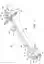 Fig. 12 - Ankle replacement system and method
