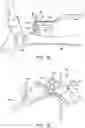 Fig. 15 - Ankle replacement system and method