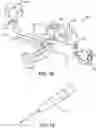Fig. 17 - Ankle replacement system and method