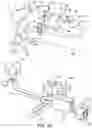 Fig. 19 - Ankle replacement system and method