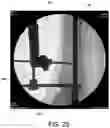 Fig. 20 - Ankle replacement system and method