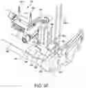 Fig. 30 - Ankle replacement system and method
