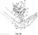 Fig. 31 - Ankle replacement system and method