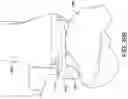 Fig. 34 - Ankle replacement system and method
