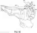 Fig. 37 - Ankle replacement system and method