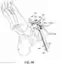 Fig. 46 - Ankle replacement system and method