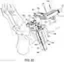 Fig. 48 - Ankle replacement system and method