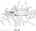 Fig. 50 - Ankle replacement system and method