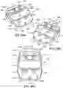 Fig. 52 - Ankle replacement system and method