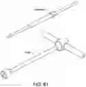 Fig. 58 - Ankle replacement system and method