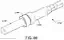 Fig. 63 - Ankle replacement system and method