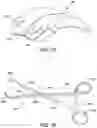 Fig. 69 - Ankle replacement system and method
