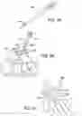 Fig. 71 - Ankle replacement system and method