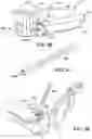 Fig. 74 - Ankle replacement system and method