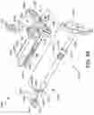 Fig. 75 - Ankle replacement system and method